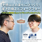 「ビジネスも恋愛も、歯並びで損をしたくない」——30代男性が手にした、想像以上の変化と1年間の軌跡
